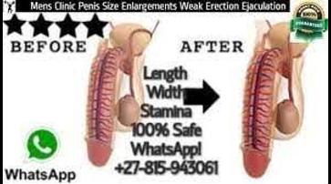 Mens Clinic ⓿❽❶❺❾❹❸⓿❻❶ Penis Enlargements Pills Boosters for sale in Johannesburg Soweto Katlehong Tembisa